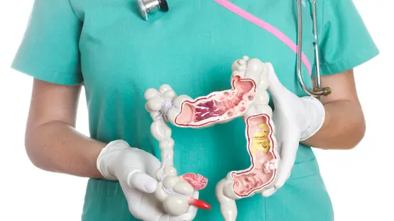 كيف تتخلص من أعراض القولون العصبي بأبسط العلاجات؟